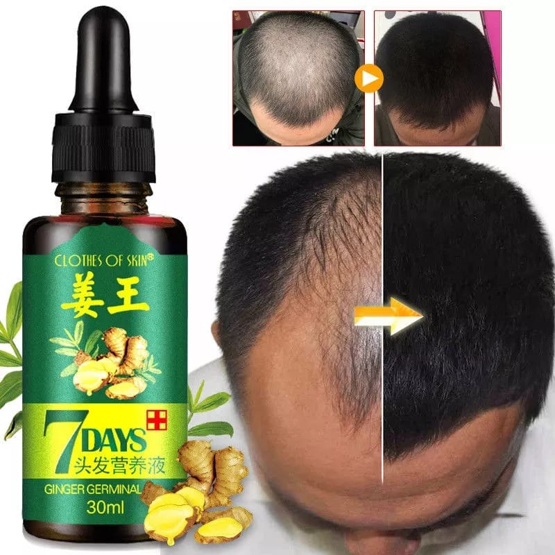 Natural Hair Grow Spray&Serum 30ML