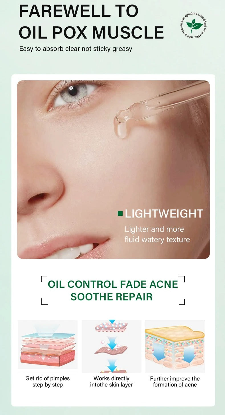 Face Serum & Dark Spot Correcting Serum for Glowing Skin | Acne Skin Care Products 30ml