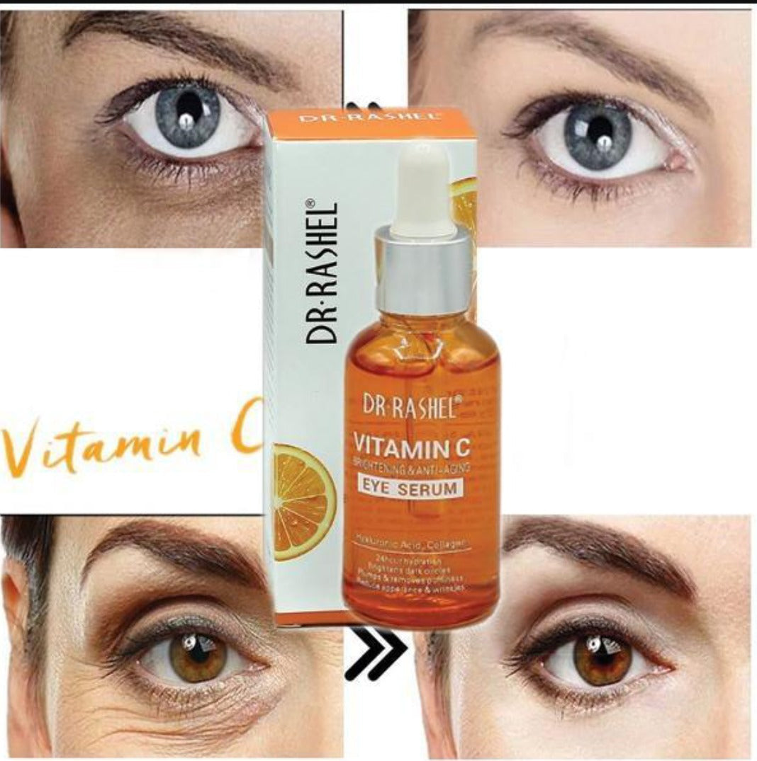 Radiant Glow Vitamin C Eye Serum – 30ml