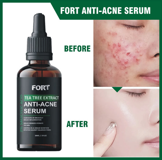 Face Serum & Dark Spot Correcting Serum for Glowing Skin | Acne Skin Care Products 30ml