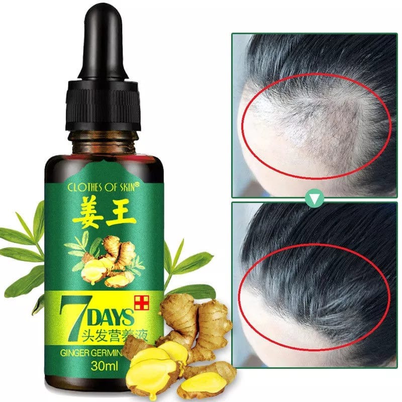 Natural Hair Grow Spray&Serum 30ML