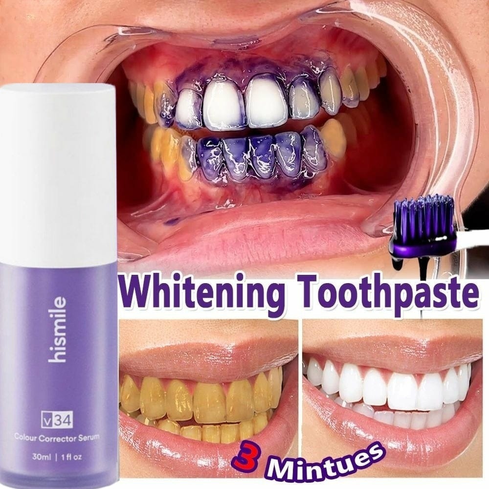 Teeth Removing Deep Smoke Stains Gingiva Protection Purple Orthopedic Toothpaste, Purple Teeth Whitening Toothpaste Kit