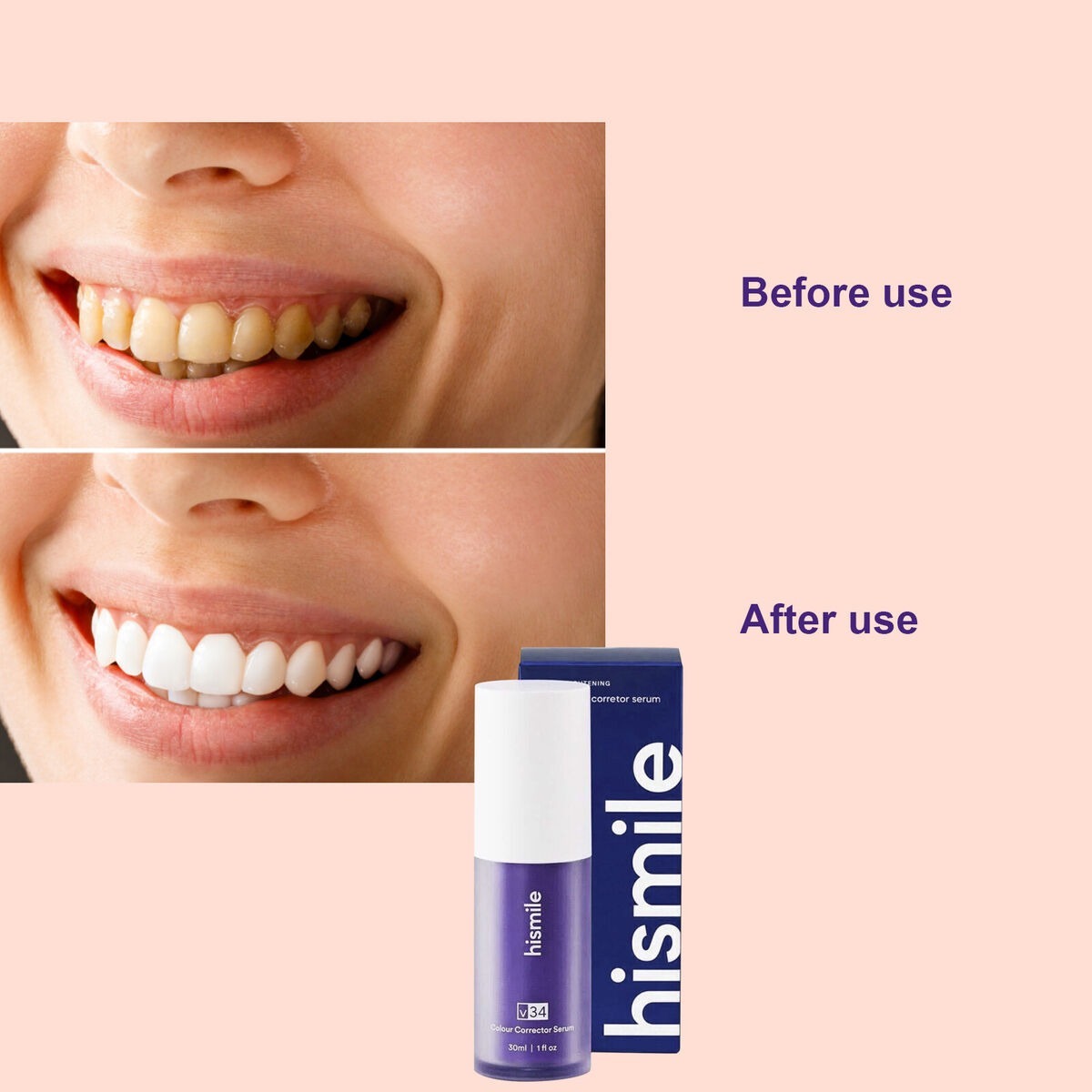 Teeth Removing Deep Smoke Stains Gingiva Protection Purple Orthopedic Toothpaste, Purple Teeth Whitening Toothpaste Kit