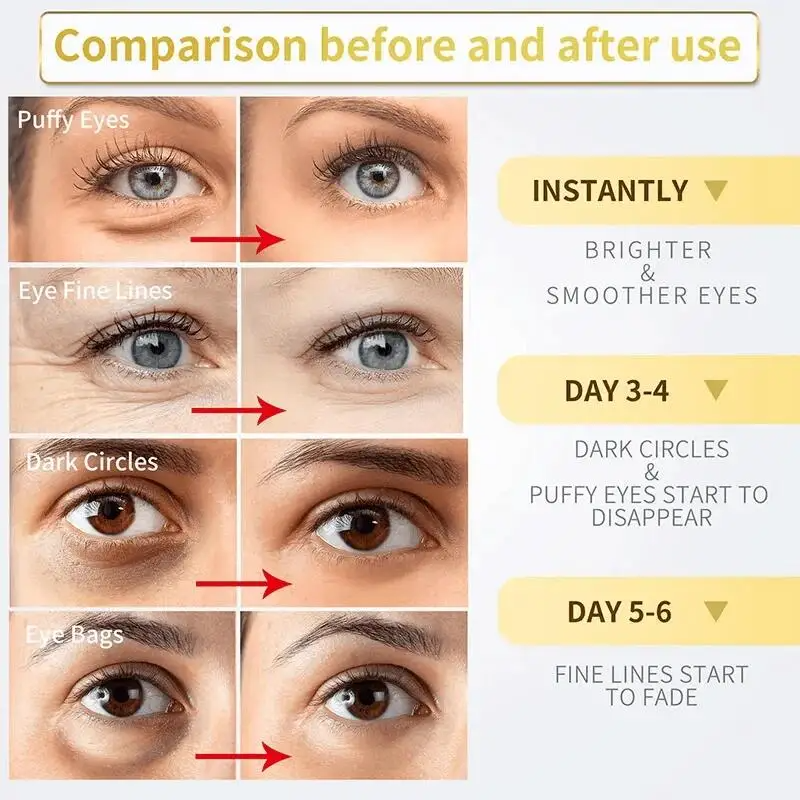 Eye Gel Remove Dark Circles 3oml