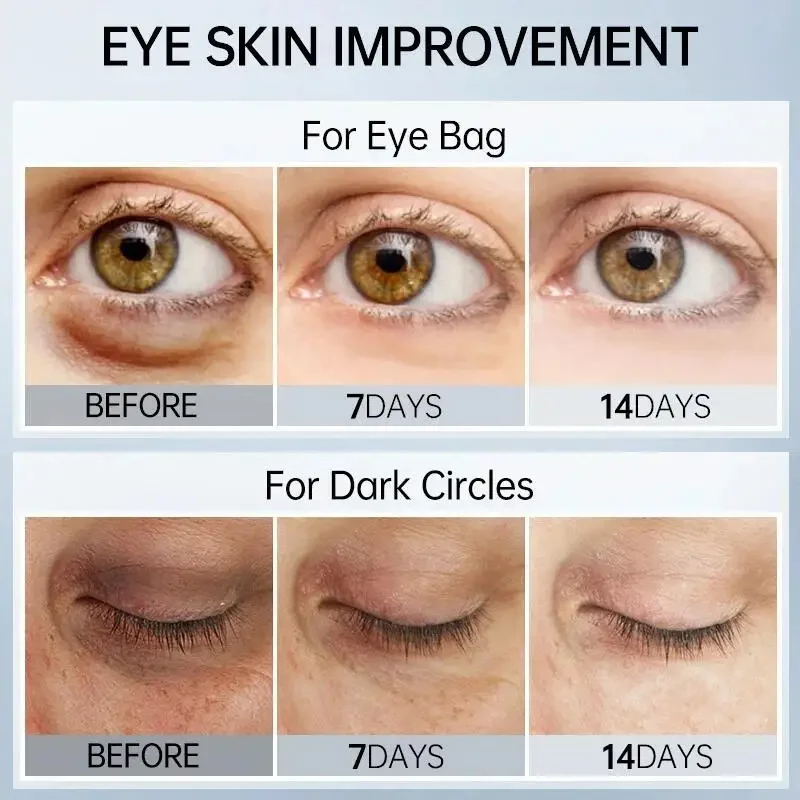 Eye Gel Remove Dark Circles 3oml